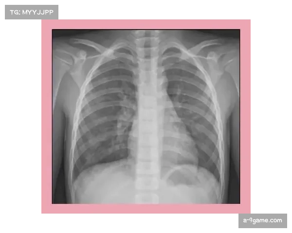 雷迪克因扣篮导致手腕受伤 进行X光检查结果显示未见异常